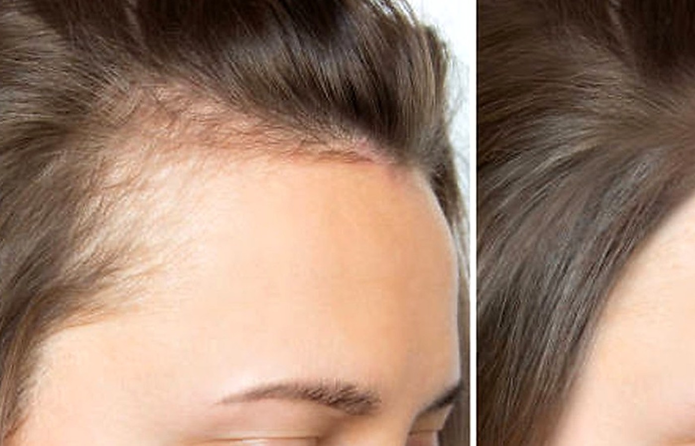 Simple Changes for Hair Growth